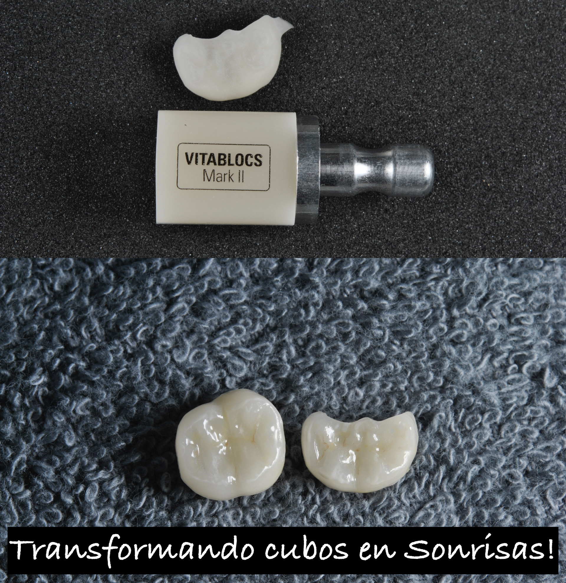 Caso clínico — Restauraciones cerámicas